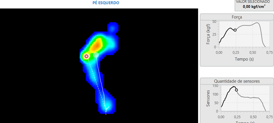Tela do pé esquerdo com mapa de pressão e gráfico de força